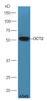 OCT2 Rabbit Polyclonal Antibody