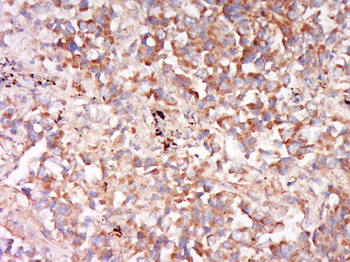 OCT2 Rabbit Polyclonal Antibody