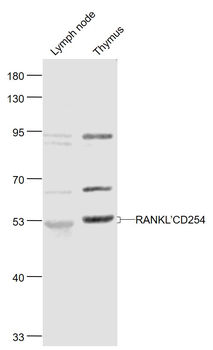 RANKL/CD254 Rabbit Polyclonal Antibody