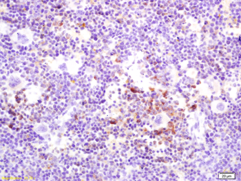 RANKL/CD254 Rabbit Polyclonal Antibody