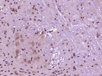 Orexin receptor 1+2 Rabbit Polyclonal Antibody