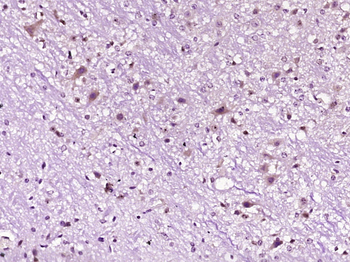 Orexin receptor 1+2 Rabbit Polyclonal Antibody