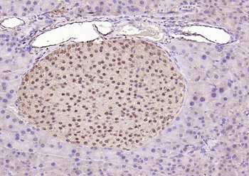 CDKN2A/p16-INK4a Rabbit Polyclonal Antibody