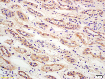 CDKN2A/p16-INK4a Rabbit Polyclonal Antibody