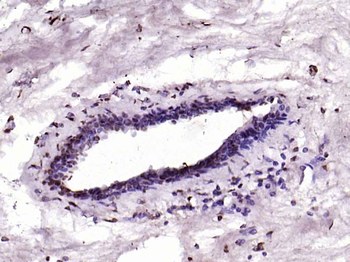 CDKN1A/p21 Rabbit Polyclonal Antibody