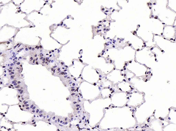 CDKN1A/p21 Rabbit Polyclonal Antibody