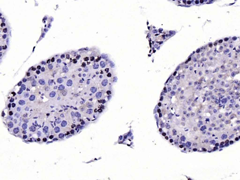 CDKN1A/p21 Rabbit Polyclonal Antibody