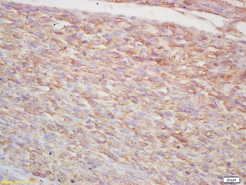 P38 MAPK Rabbit Polyclonal Antibody