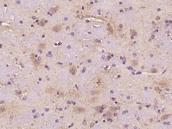 P38 MAPK Rabbit Polyclonal Antibody