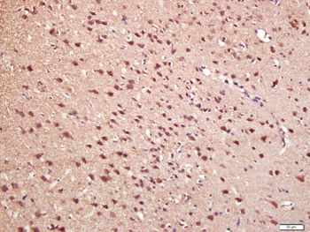 Phospho-P38 MAPK (Thr180 + Tyr182) Rabbit Polyclonal Antibody