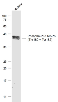 Phospho-P38 MAPK (Thr180 + Tyr182) Rabbit Polyclonal Antibody