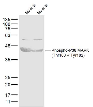 Phospho-P38 MAPK (Thr180 + Tyr182) Rabbit Polyclonal Antibody