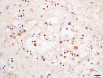 Phospho-P38 MAPK (Thr180 + Tyr182) Rabbit Polyclonal Antibody