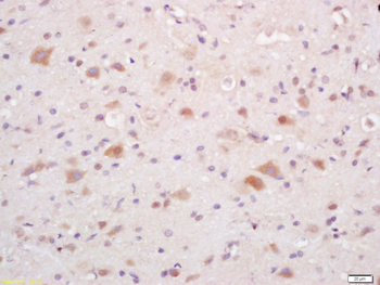 Phospho-P38 MAPK (Thr180 + Tyr182) Rabbit Polyclonal Antibody