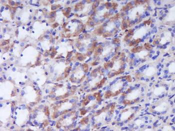 MEK3 Rabbit Polyclonal Antibody