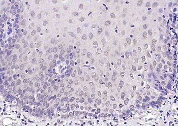 Phospho-P53 (Ser392) Rabbit Polyclonal Antibody