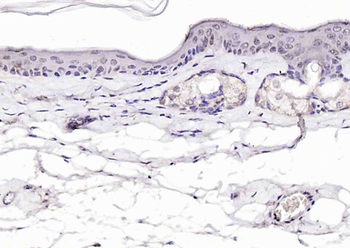Phospho-P53 (Ser392) Rabbit Polyclonal Antibody
