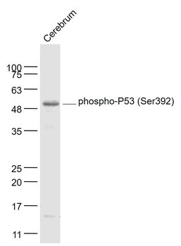 Phospho-P53 (Ser392) Rabbit Polyclonal Antibody
