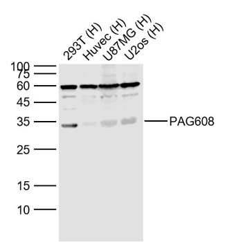 PAG608 Rabbit Polyclonal Antibody