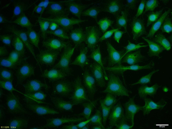 P73 Rabbit Polyclonal Antibody