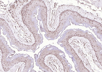 P73 Rabbit Polyclonal Antibody