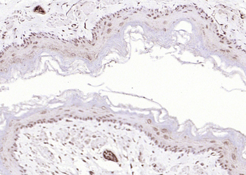 P73 Rabbit Polyclonal Antibody
