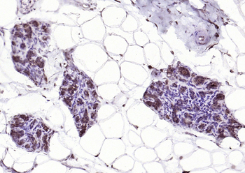 P73 Rabbit Polyclonal Antibody