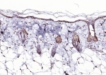 P73 Rabbit Polyclonal Antibody