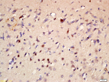 P73 Rabbit Polyclonal Antibody