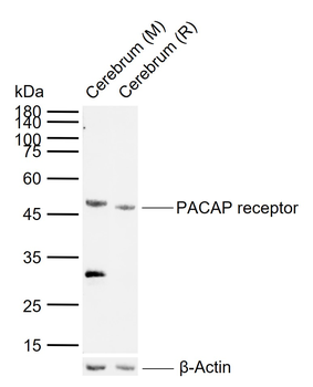 PACAP receptor Rabbit Polyclonal Antibody