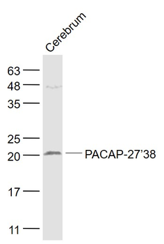 PACAP-27/38 Rabbit Polyclonal Antibody