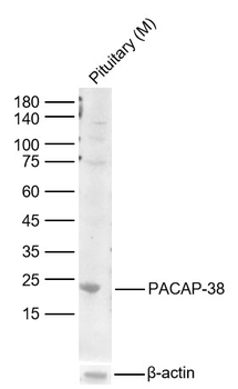 PACAP-38 Rabbit Polyclonal Antibody