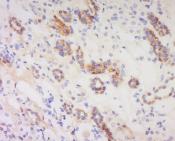 PACAP-38 Rabbit Polyclonal Antibody