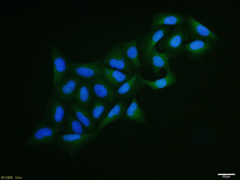 PALB2 Rabbit Polyclonal Antibody