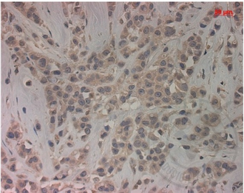PALB2 Rabbit Polyclonal Antibody
