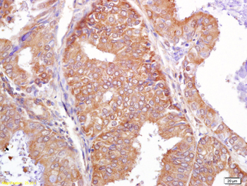 PALB2 Rabbit Polyclonal Antibody