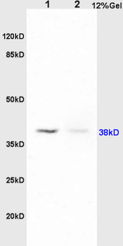 PAFR/PAF Receptor Rabbit Polyclonal Antibody
