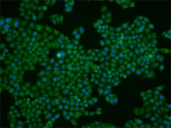 Phospho-PAK1 (Ser144) + PAK3 (Ser154) Rabbit Polyclonal Antibody