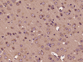 Phospho-PAK1 (Ser144) + PAK3 (Ser154) Rabbit Polyclonal Antibody