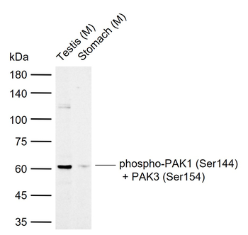 Phospho-PAK1 (Ser144) + PAK3 (Ser154) Rabbit Polyclonal Antibody