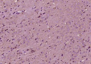 PAR1 Rabbit Polyclonal Antibody