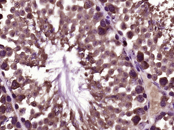 PAR1 Rabbit Polyclonal Antibody