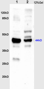 PAR1 Rabbit Polyclonal Antibody
