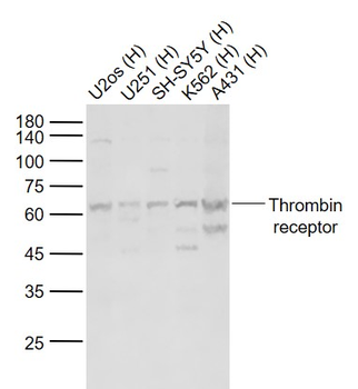 PAR1 Rabbit Polyclonal Antibody
