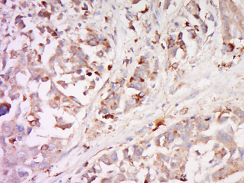 PAR1 Rabbit Polyclonal Antibody