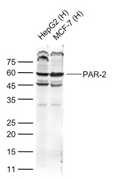 PAR-2 Rabbit Polyclonal Antibody