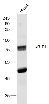 KRIT1 Rabbit Polyclonal Antibody