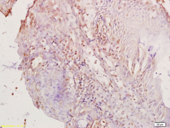 PAX8 Rabbit Polyclonal Antibody