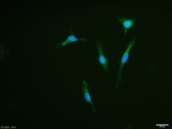 PAX8 Rabbit Polyclonal Antibody