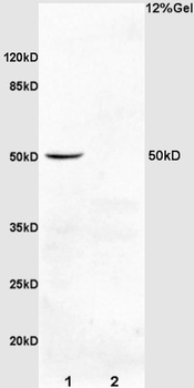 PDCD4 Rabbit Polyclonal Antibody